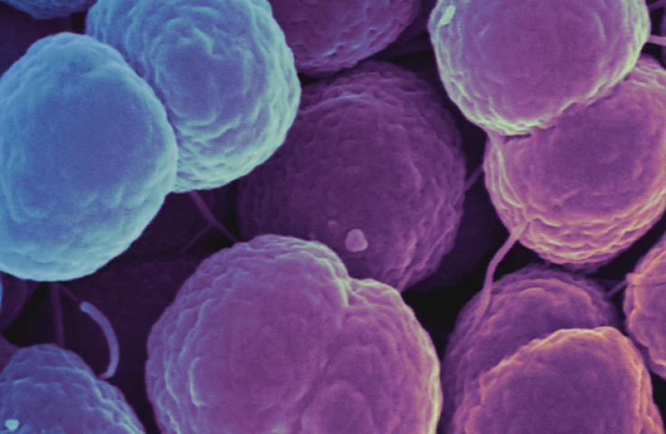 Gonorrhoea cells. Credit: National Institute of Allergy and Infectious Diseases, National Institutes of Health.
